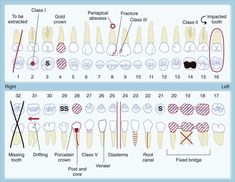 image Dental Hygienist School, Tooth Implant, Medical Items