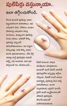 Telugu Vattulu Words, Vantalu In Telugu, Hair Growth Tips In Telugu, Good Health Tips In Telugu, Vemana Padyalu In Telugu, Ayurveda Recipes, Natural Face Skin Care, Healthy Indian Recipes, Ayurvedic Healing