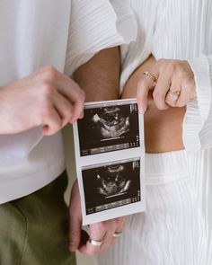 a man and woman holding an x - ray image in their hands while they both wear wedding rings