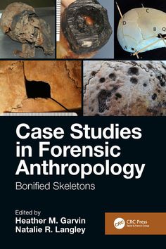 the cover of case studies in forensic and anthropy by jonathan m gavrin