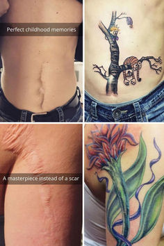 the before and after pictures of tattoo removals