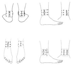 four different types of feet and ankles with dots on the soles, from top to bottom