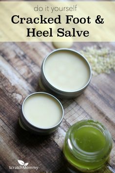 A super simple, crazy effective DIY Cracked Foot and Heel Salve Recipe which will absolutely get your feet ready for spring and summer. Get the recipe here! Diy Health