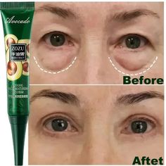 7 Day Tighten Wrinkles Eye Cream Anti Dark Circles Bags Puffiness Fade Tighten Under Eye Skin, Wrinkles Remedies Face, Dark Circles Around Eyes, Wrinkles Remedies, Eye Wrinkle Cream, Eye Skin Care, Natural Skin Care Remedies, Facial Wrinkles, Remove Dark Circles