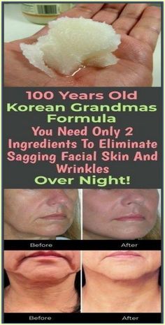 YOU NEED ONLY 2 INGREDIENTS TO ELIMINATE SAGGING FACIAL SKIN AND WRINKLES OVER NIGHT Facial Wrinkles, Over Night, Skin Remedies, Beautiful Body, Sagging Skin, 2 Ingredients