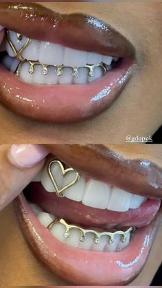 Gold Teeth Grills Aesthetic, Gold Teeth Grills Black Women, Women’s Gold Grill, Golds On Black Women Teeth, Black Women Grillz Aesthetic, Grills Black Women Aesthetic, Two Piece Grillz, Wedding Grills Teeth, Gold Teeth Gems