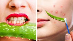 GENIUS ALOE VERA IDEAS FOR EVERY OCCASIONHow to use aloe to clean your face from pimples, remove unwanted hair and treat sunburn? Save a tone of money and ti... Sunburn On Face, Beauty Routine Planner, Acne Hacks, Remove Unwanted Hair, Skin Polish, Foot Mask, Unwanted Hair Removal, Skin Benefits