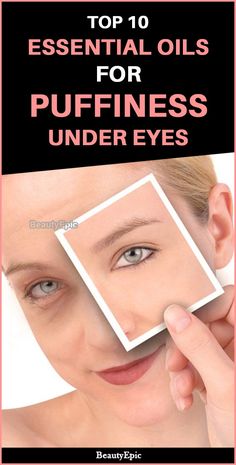 Puffiness Under Eyes, Nails Dark Skin, Skin Essential Oils, Dry Eyes Causes, Nails Dark, Eyes Problems, Super Nails