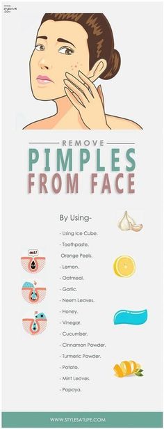 To Remove Pimples, Remove Pimples, Skin Moles, Natural Acne Remedies, Types Of Acne, How To Get Rid Of Pimples