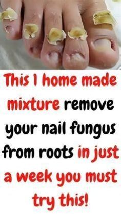 Foot Fungus Soak, Homemade Nail Polish