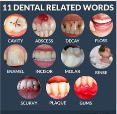 dental related words are shown in this poster