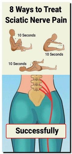 a diagram showing how to treat sciatic nerve pain