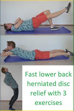 I discuss the L5-S1 herniated disc cause, symptoms, and treatment with 3 exercises. Avoid exercises and activities that increase the pressure Herniated Disk L5 S1, Disk Herniation Physical Therapy, Bulging Disc Exercises, Disc Exercises, Sciatic Nerve Pain Relief, Therapy Exercises, Bulging Disc, Sciatica Exercises, Sciatica Pain Relief