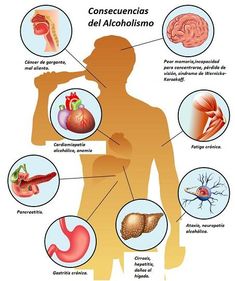 17 Consecuencias del Alcoholismo en la Salud Alcohol Effects, Giving Up Alcohol, Poor Nutrition, Alcohol Content, Body Organs, Types Of Cancers, Photo Images, Work Office