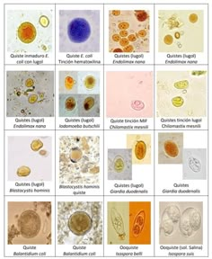 some pictures of different types of cells and their functions in the human body, including an egg