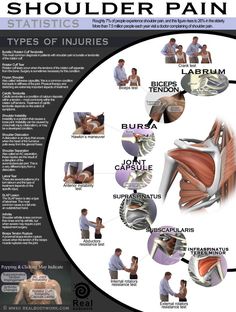 All About Shoulder Pain {Infographic} Pain Chart, Human Skeletal System, Frozen Shoulder, Frosé, Hand Therapy, Med Student, Anatomy And Physiology, Shoulder Pain