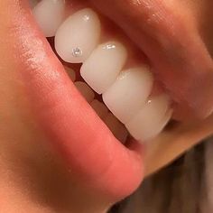 a close up of a person's mouth with teeth and gums on it