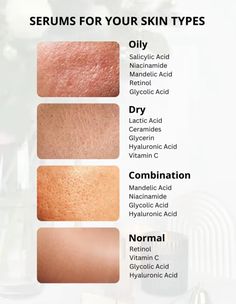 Skin Care Routine For Oily Skin, Oily Face Remedy, Acne Types, Serum For Oily Skin, Oily Skin Face, Beauty Treatments Skin Care