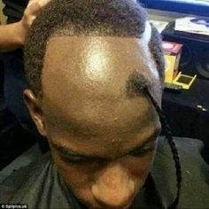 Hairstyles For Bad Hairline, Ugly Hair Cuts, Worst Haircut Ever, What Haircut Should I Get, Bad Hairline, Hair Fails, Waves Haircut