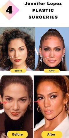 the before and after pictures of plastic surgery for women with different types of face shapes