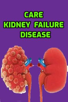 What if you could restore your kidney function back to good health .What if you could go from stage 4 to 3, to 2, to 1 within months .✔ No dialysis ✔ No medication ✔ Get your life back ✔ Be energised again ✔ Enjoy food again ✔ Sleep well again. Discover the Kidney Disease Solution for yourself. . Healthy Living Inspiration, Chronic Kidney, Medical Insurance, Sleep Well, Get Your Life, Good Health