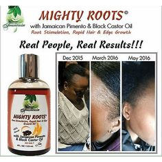 Buy Jamaican Black Castor & Pimento Mighty Roots Edge Growth Oil/Satin Cap 4ozDo you need to restore, renew or grow back your thinning hair or non-existent edges and hair line??If, so then you need Fountain Mighty Roots, a revolutionary conditioning and nourishing treatment that will rapidly grow back your hairFountain Mighty Roots 4 oz is an organic deep nourishing root & scalp oil rich in vitamins, minerals and essential fatty acidsAll natural, organic ingredients nurtured in Jamaica and bottl Edge Growth, Hair Growth Products, New Hair Growth, Grow Long Hair, Black Castor Oil, Hair Growth Serum, Fast Hairstyles, Grow Hair Faster, For Hair Growth