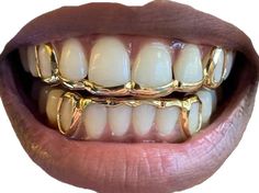 a woman's mouth with gold teeth and braces on the bottom half of it