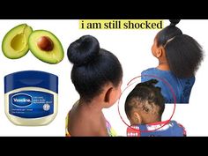 How I Used AVOCADO and VASELINE For Extreme Hair Growth and Thickness. - YouTube Extreme Dry Skin Remedy, Vaseline Diy, Product For Hair Growth, Nails Growth, Magical Nails, Vaseline For Hair, Hair Growth Product, Hair Recipes, Dry Natural Hair