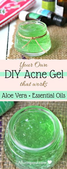 diy acne gel Facial Remedies, Joululahjat Diy, Painful Acne, Make Up Diy, Make Up Foundation, Diy Acne, Diy Kosmetik, Baking Soda Shampoo