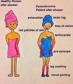 POTS - Let's talk showers... (I'm not quite this bad but close!) Swollen Legs, Migraine