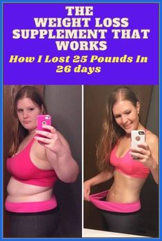 How I lost 63 pounds in 4 months without exercise #weightlos Lose 25 Pounds, Are You Serious, Lose Pounds, 20 Pounds, Losing Me