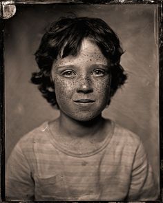 an old black and white photo of a boy with freckles on his face