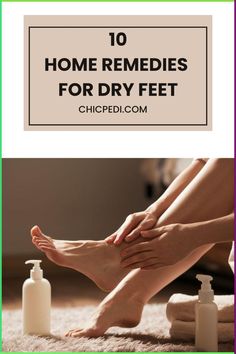 Use These 10 Powerful Home Remedies For Dry Feet. Learn How To Soften Feet At Home With Everyday Household Products. Dry Feet Remedies, Nail Fungus, Homemade Remedies, Household Products, Foot Health