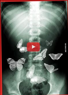 an x - ray image with butterflies flying in the air and on top of it