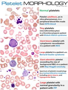 the different types of platelet morphlocytes are shown in this diagram