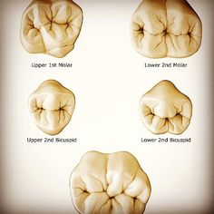 Dental Drawings, Dentist Funny, Dental Ceramics, Hygiene School, Teeth Anatomy, Dental Images