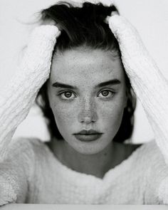 a black and white photo of a woman with freckled hair covering her eyes