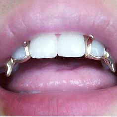 Teeth Grills, Fang Grillz, Teeth Whitening Diy, Gold Grillz