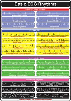 Cardiology Nursing, Paramedic School, Nursing Mnemonics, Cardiac Nursing, Pharmacology Nursing, Nursing School Survival, Critical Care Nursing, Nursing School Studying, Nursing School Tips