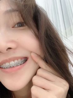 Brace Aesthetics, Braces Aesthetic Girl, Brackets Aesthetic, Gray Braces, Korean Id Photo, Braces Aesthetic, Behel Gigi, Teeth Aesthetic