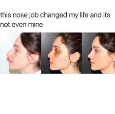 Her nose and under bag job Nose Goals, Pimple Inside Nose, Acne On Nose, Plastic Surgery Fail, Nose Jobs, Rhinoplasty Nose Jobs, Blackhead Extraction, Pretty Nose, Perfect Nose