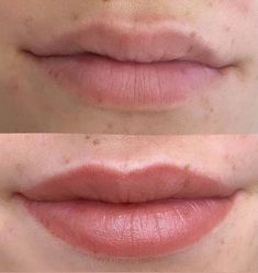 Lip Blushing adds volume, definition and colour to your lips. Enhances Lip Fillers. Gloss & Go exclusively available at Tracie Giles London. Learn Yoga, Lip Fillers, Sensitive Teeth, Natural Beauty Tips, Shape Of You, Deep Cleansing, Beauty Hacks, Blush