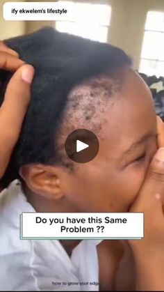 Stop Hair Breakage, Best Hair Oil, Hair Diy, Hair Breakage, Hair Oil, Care Tips, Diy Hairstyles