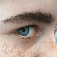 a person with freckles on their face and blue eyes looking at the camera