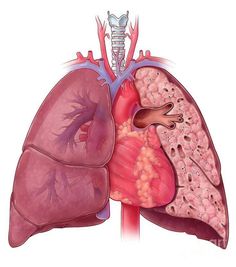 an image of the human heart and lungs