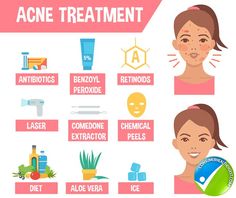 Acne: Types, Symptoms, Causes & Treatments Chin Acne Remedies, Cheek Acne, Pimples On Buttocks, Pimple Causes, Pimples On Forehead, Chest Acne, Skincare Guide, Forehead Acne