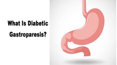 What Is Diabetic Gastroparesis? - Healthy Living The Vagus Nerve, Longevity Diet, Stomach Muscles, Healthy Recipes For Diabetics, Stomach Issues, Health Living, Stomach Problems, Vagus Nerve, Nerve Damage