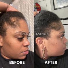 FOUR DAYS?! The holy grail for hair growth. Even for alopecia 😧🙌🏾 For Hair Growth, Four Days, Holy Grail, For Hair, Quick Saves