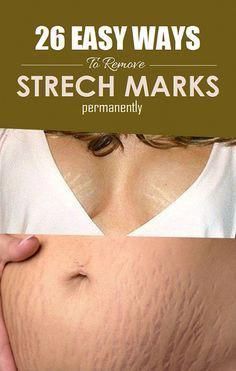 Strech Marks, Stretch Mark Remedies, Stretch Mark Removal, Stretch Mark, Makeup Tricks, Beauty Remedies, Skin Remedies, Best Anti Aging, Skin Care Acne