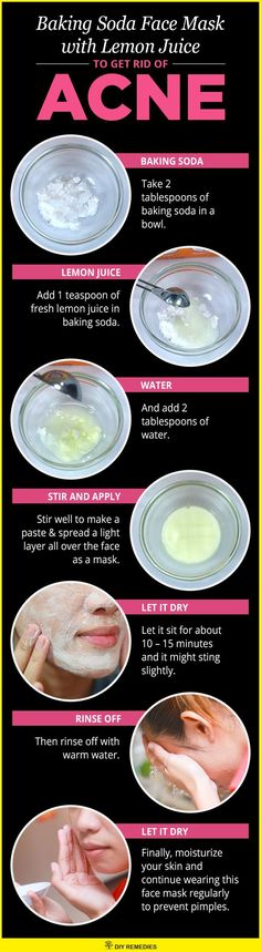 Face Masks For Acne, Masks For Acne, Baking Soda For Acne, Obličejové Masky, Baking Soda Face Mask, Baking Soda Face, Homemade Facial Mask, Acne Face Mask, Hair Bride